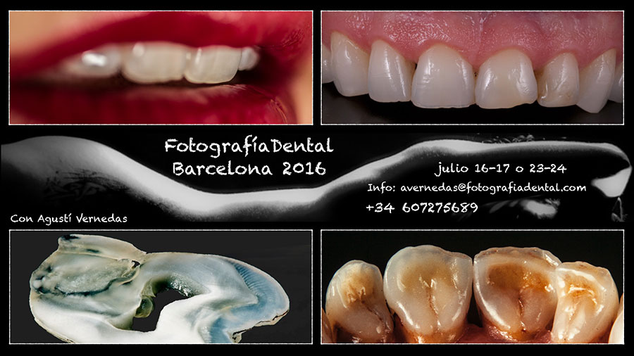 curs-foto-dental-bcn-2016-07b-02-med.jpg
